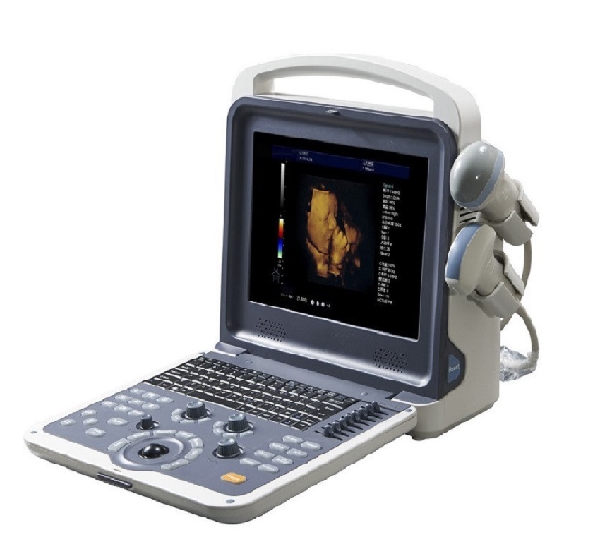UT-C6 Hand-carried Color Ultrasound Diagnostic System