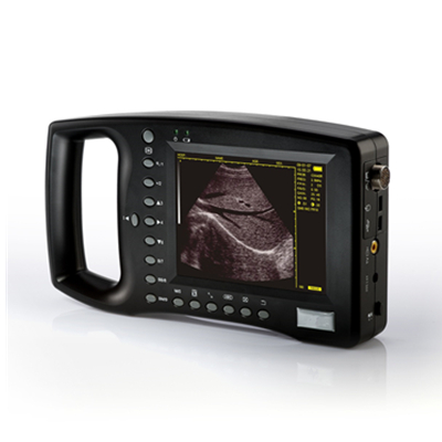 UT-B3100 Palm-size Full-digital Ultrasound Diagnostic System