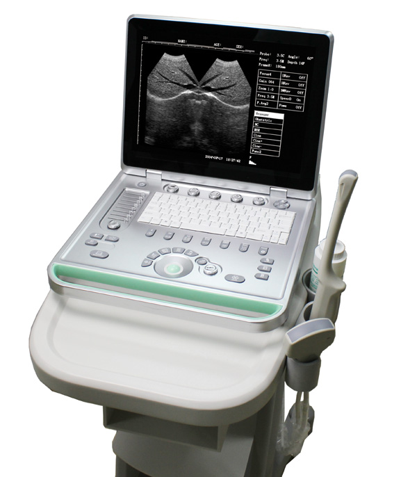 UT-V7 Laptop Ultrasound Scanner